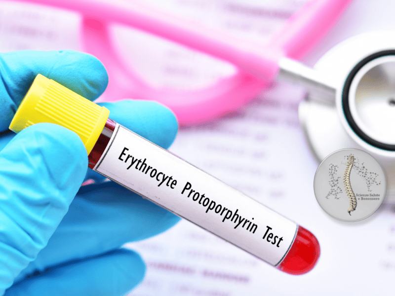 PROTOPORFIRIA ERITROPOIETICA: CONOSCIAMOLA&nbsp;MEGLIO